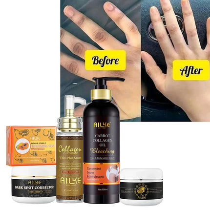 AILKE Collagen Whitening Set, Moisturizer, Hydration, Dark Spot Removal, Brightening Body Lotion, Armpit Whitening Cream